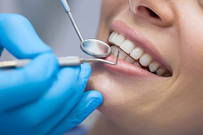 Islip Dental Checkups