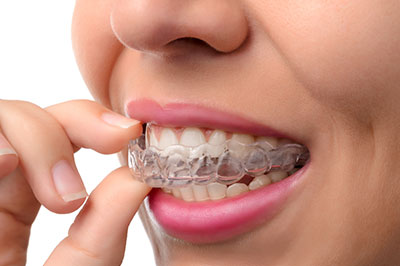 Islip invisalign