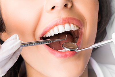 Periodontal Surgery in Islip